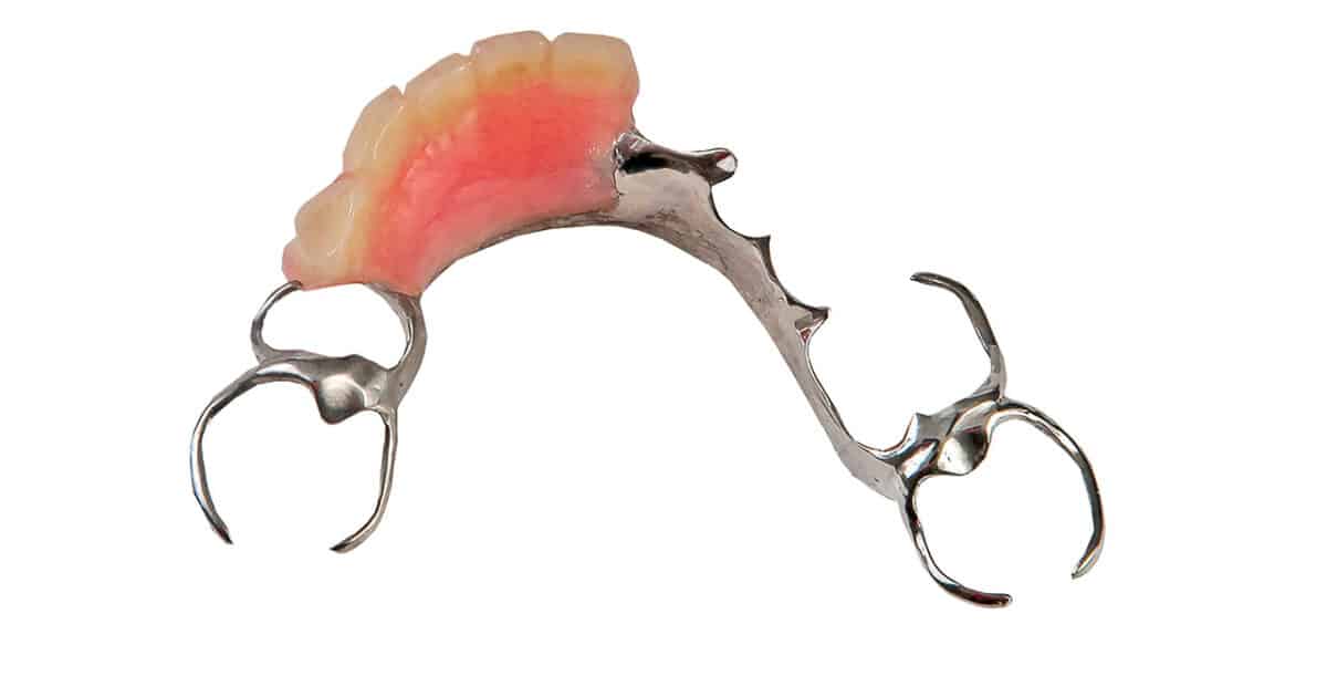 Brisbane Removable Partial Dentures