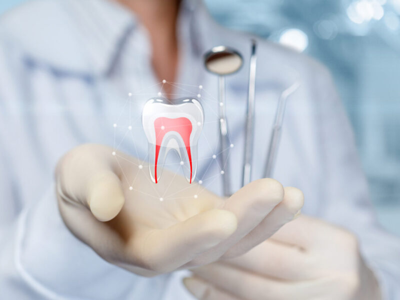 root canal treatment